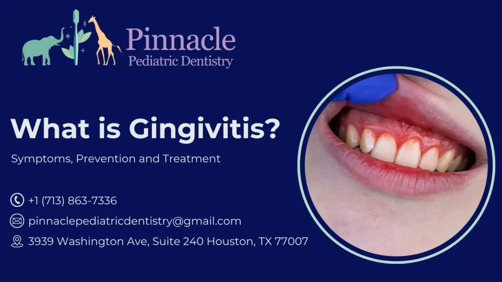 What is Gingivitis? Symptoms, Prevention and Treatment