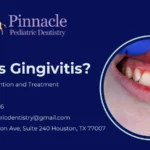 What is Gingivitis? Symptoms, Prevention and Treatment